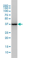 WB - ALDOA Antibody (monoclonal) (M02) AT1116a